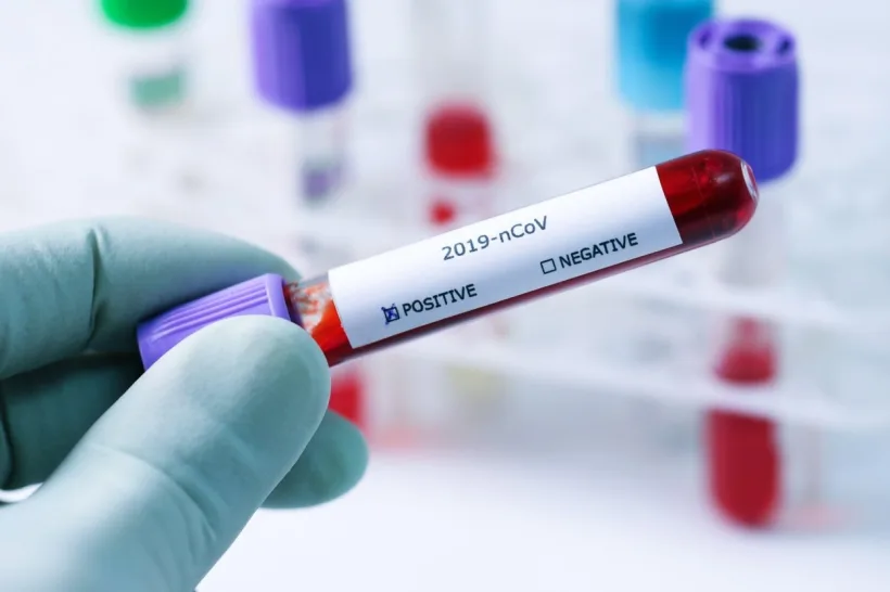 Deces provocat de coronavirus la Galați. Un bărbat de 77 de ani, care avea și alte afecțiuni