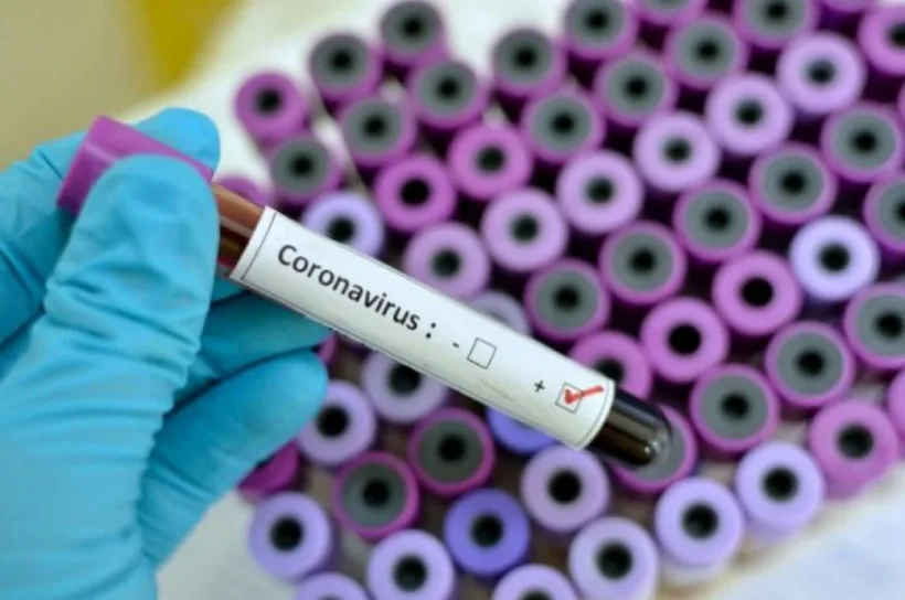 Bilanțul cazurilor de COVID-19: 5.467 de persoane infectate