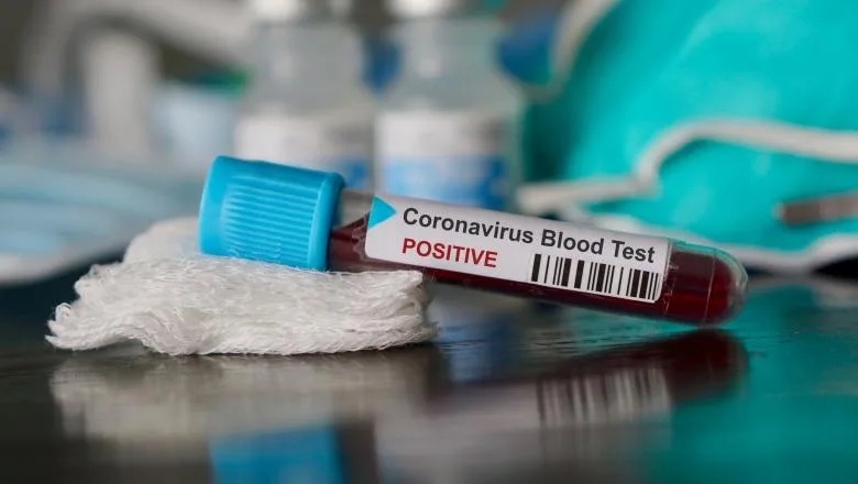 11.339 de infecții, dintre care 631 de morți din cauza COVID-19
