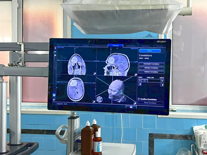 Premieră medicală în neurochirurgie la Spitalul Județean Galați: prima operație pe creier realizată cu ajutorul Sistemului de Neuronavigație