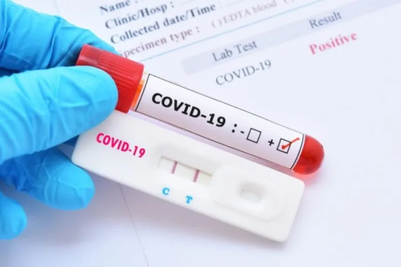 PSD cere schimbarea protocolului de testare pentru COVID-19