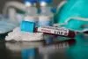 Primul caz de coronavirus în România: Pacientul a ajuns la "Matei Balş"