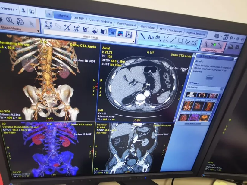 Ziua Mondială de Luptă Împotriva Cancerului: Județul Galați a devenit centru regional de tratare și diagnosticare