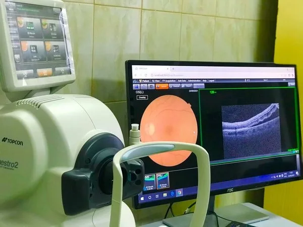 Aparate medicale care schimbă viața pacienților: tomograful retinian de la Spitalul Județean Galați