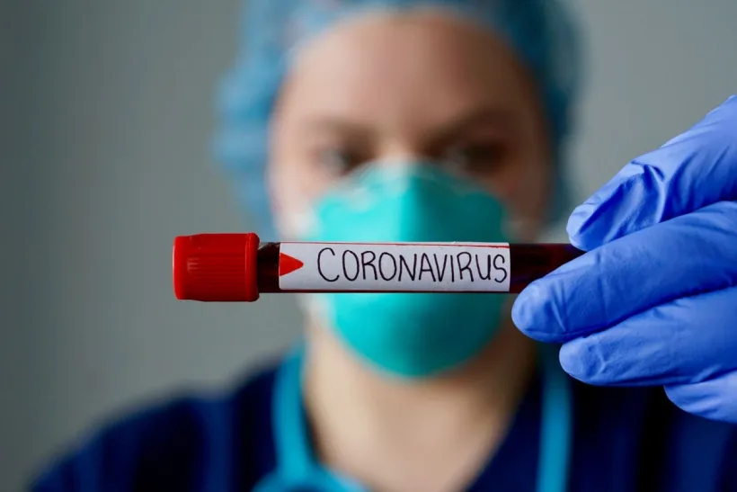 Măsuri adoptate privind evitarea răspândirii infecției cu COVID-19