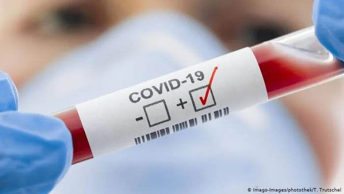 Numărul cazurilor de îmbolnăvire cu noul coronavirus la nivel național a ajuns la 70