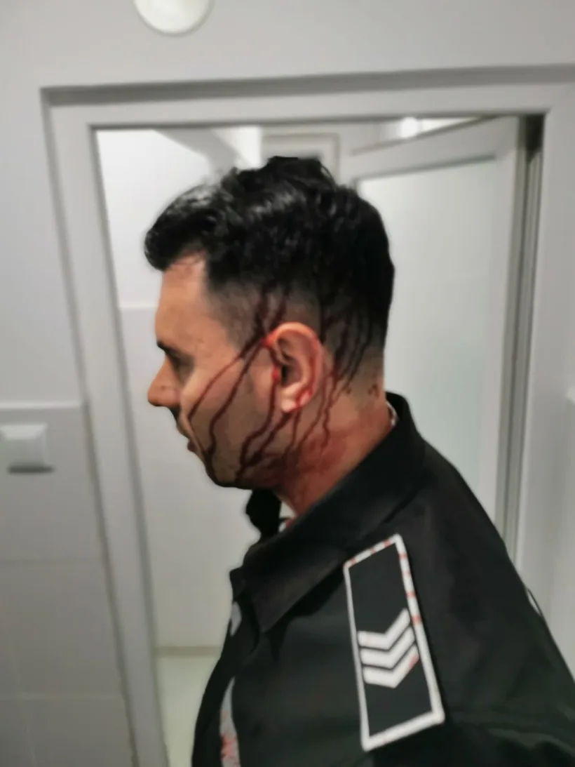 Polițist local rănit grav la cap. A fost atacat cu obiecte aruncate de la geamurile unui bloc